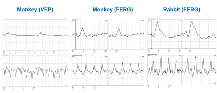 The system is applied to detect ophthalmic electrophysiological items, like ERG, VEP, EOG, etc.